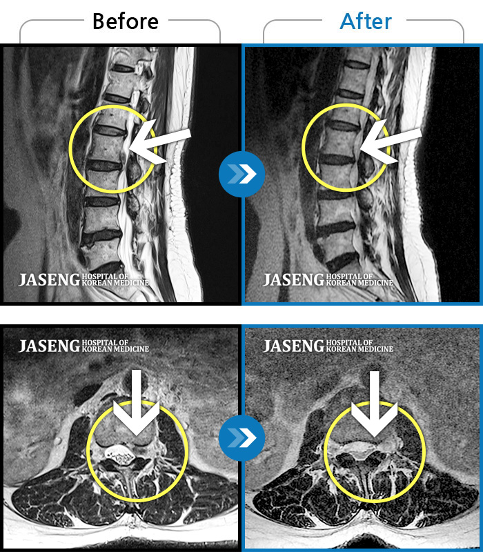 ڻѹ溴 ġ MRI  ġ-ó   㸮    ,  ٸ   ϰ ־  Ȱ , ߰ ᵵ  ڰ  Ͽ  Ȱ  ¼̽ϴ. 