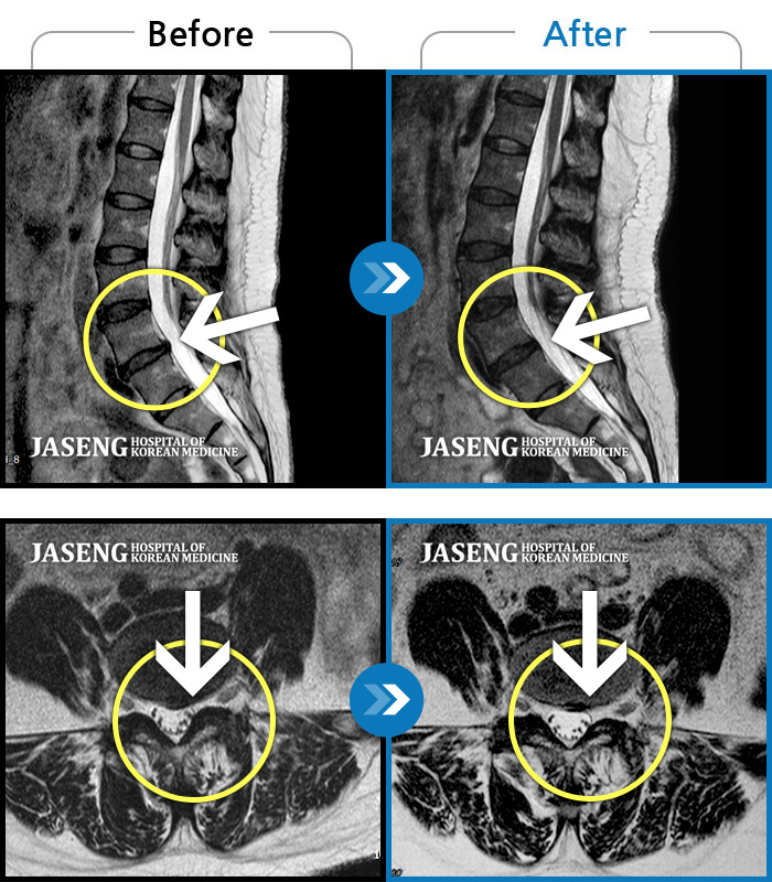 õڻѹ溴 ġ MRI  ġ-ó   㸮 ٸ   · ϼ̽ϴ.