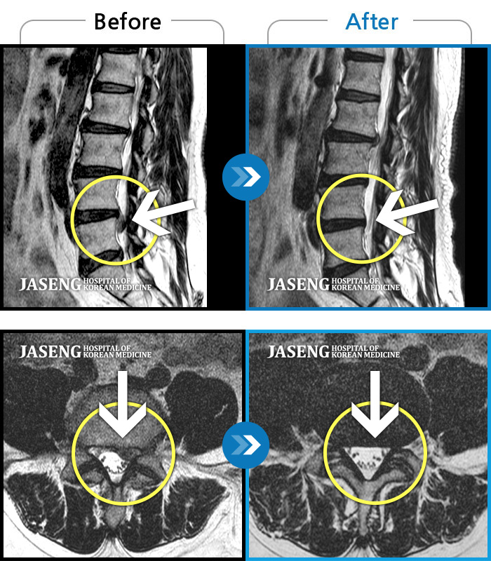 õڻѹ溴 ġ MRI  ġ-2023.12濡 濡 ȴٰ ߲  ߻ 㸮   Դϴ.